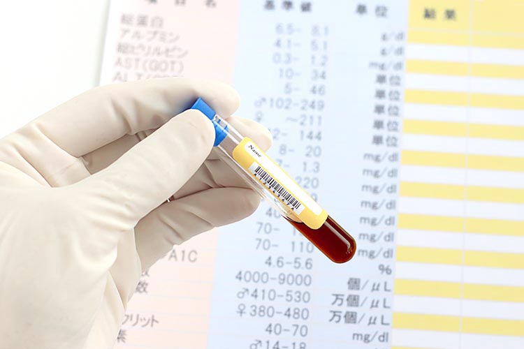 健康診断イメージ